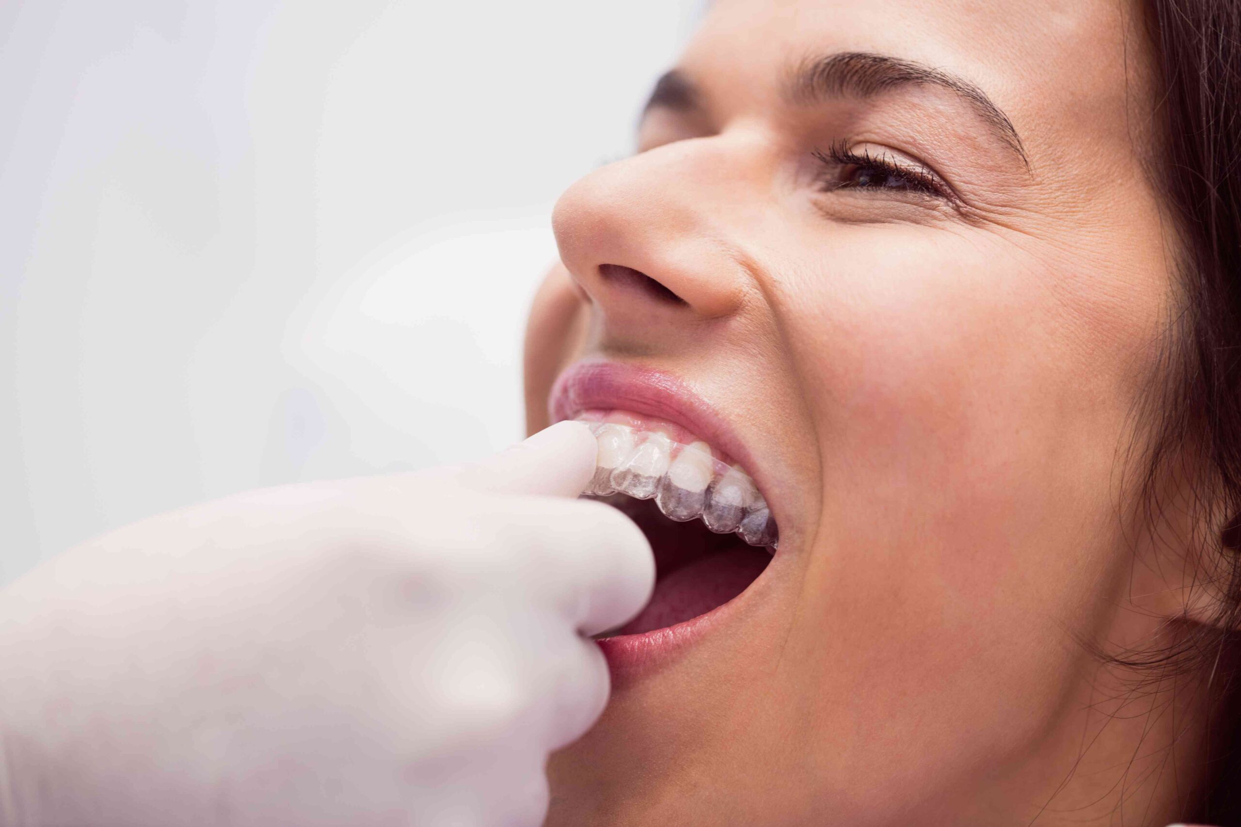 Maximizing Comfort During Invisalign Treatment: Insights from Lewisville Specialists