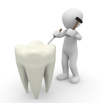 Why Regular Dental Check-Ups Can Prevent Root Canal Needs